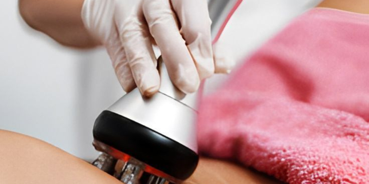 Cool Sculpting | Royal Clinic Saudia: Body Confidence Starts Here