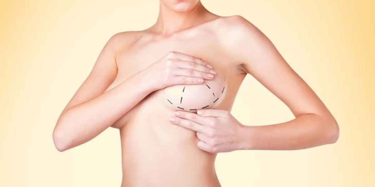 Breast Reduction in Dubai: Choosing the Right Surgeon