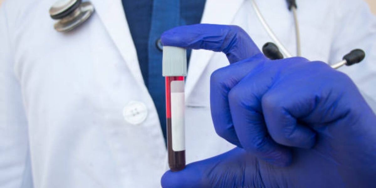Blood Test at Home: Understanding the Numbers