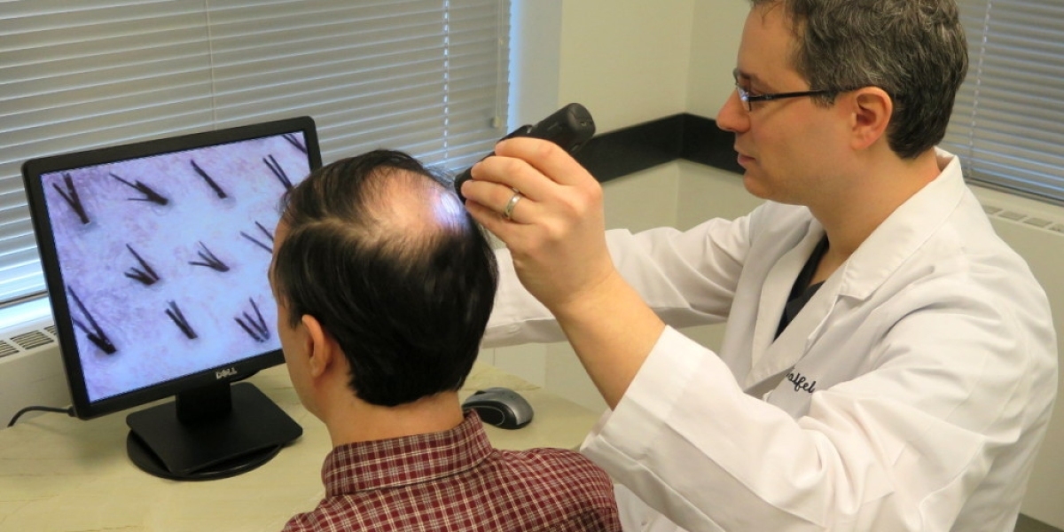 How Modern Hair Systems Deliver Instant Hair Volume and Coverage