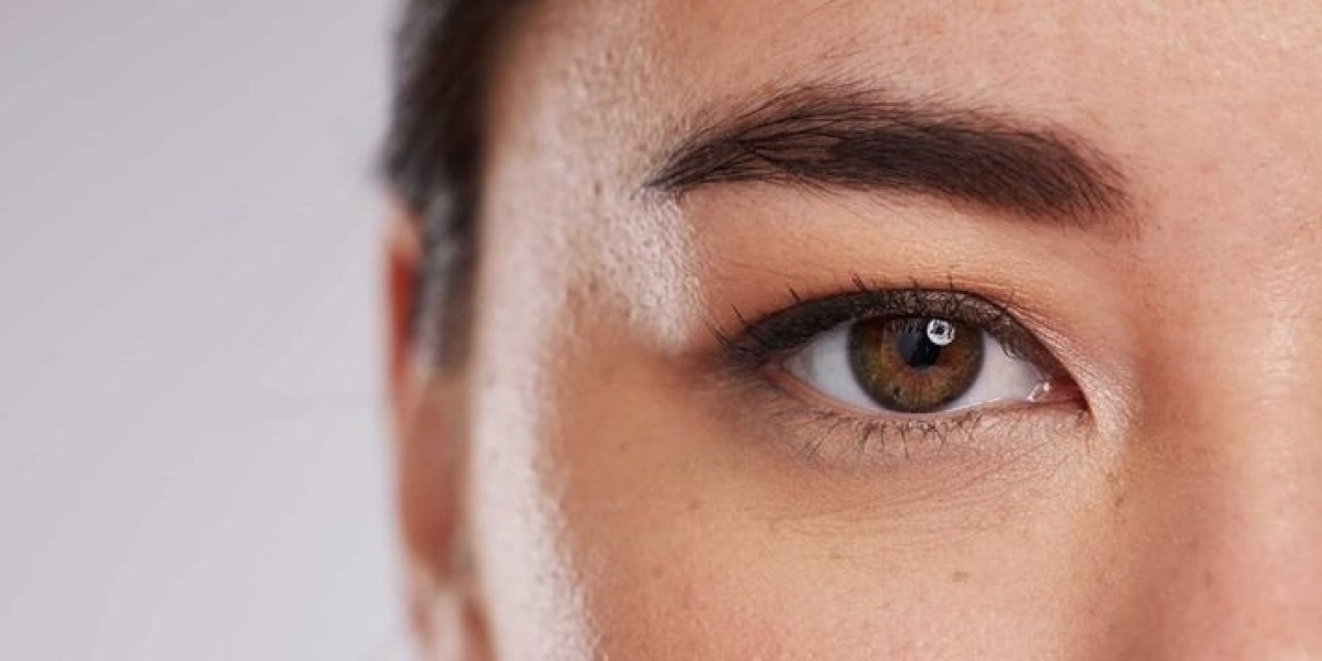 Upper Blepharoplasty Dubai: Enhance Your Eye Appearance with Precision