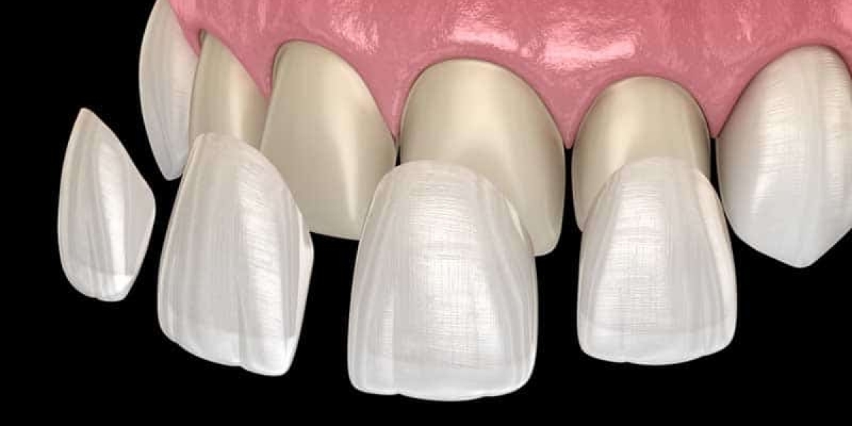Radiant Smile Transformation with Modern Cosmetic Elegance