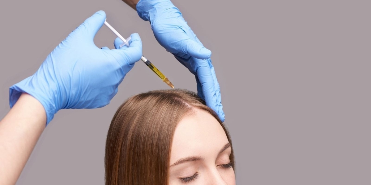 Visible Hair Growth Improvements After PRP Hair Treatment in Dubai