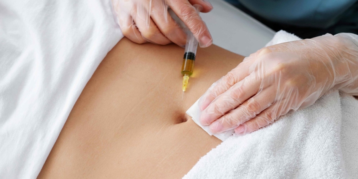 Fat Melting Injections vs Liposuction: Which Is Better?