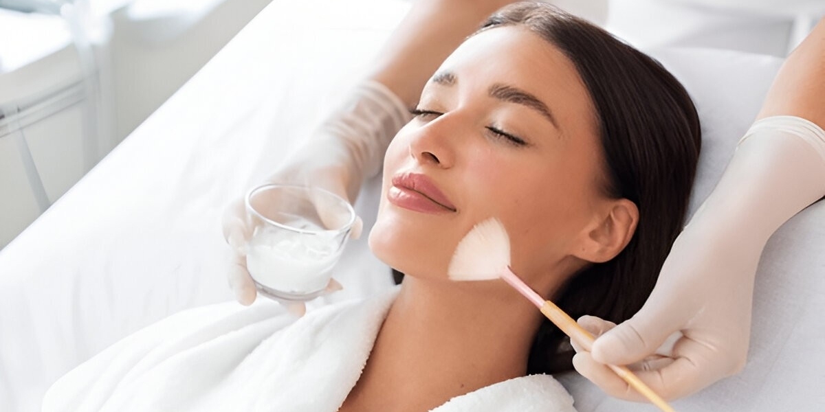 Chemical Peels for Smoother, Softer, and Clearer Skin