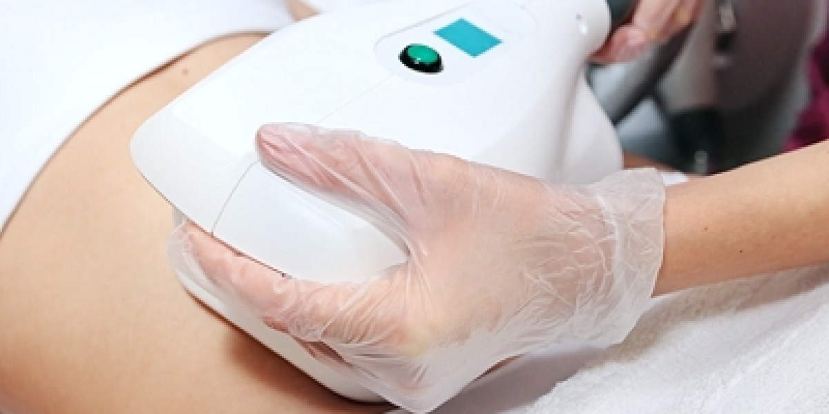 Striking body sculpting with CoolSculpting for effortless body refinement