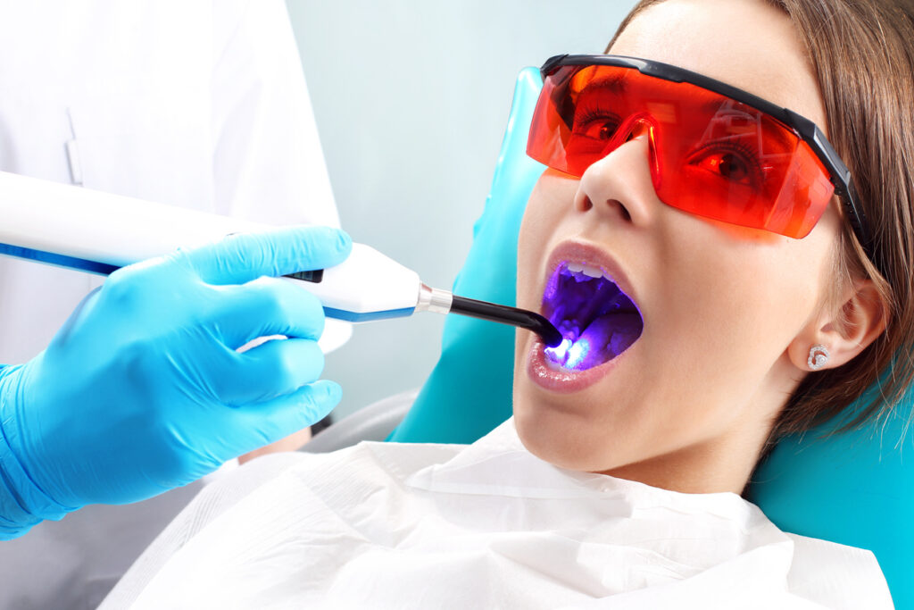 How Dental Sealants Help Prevent Cavities in Children and Adults