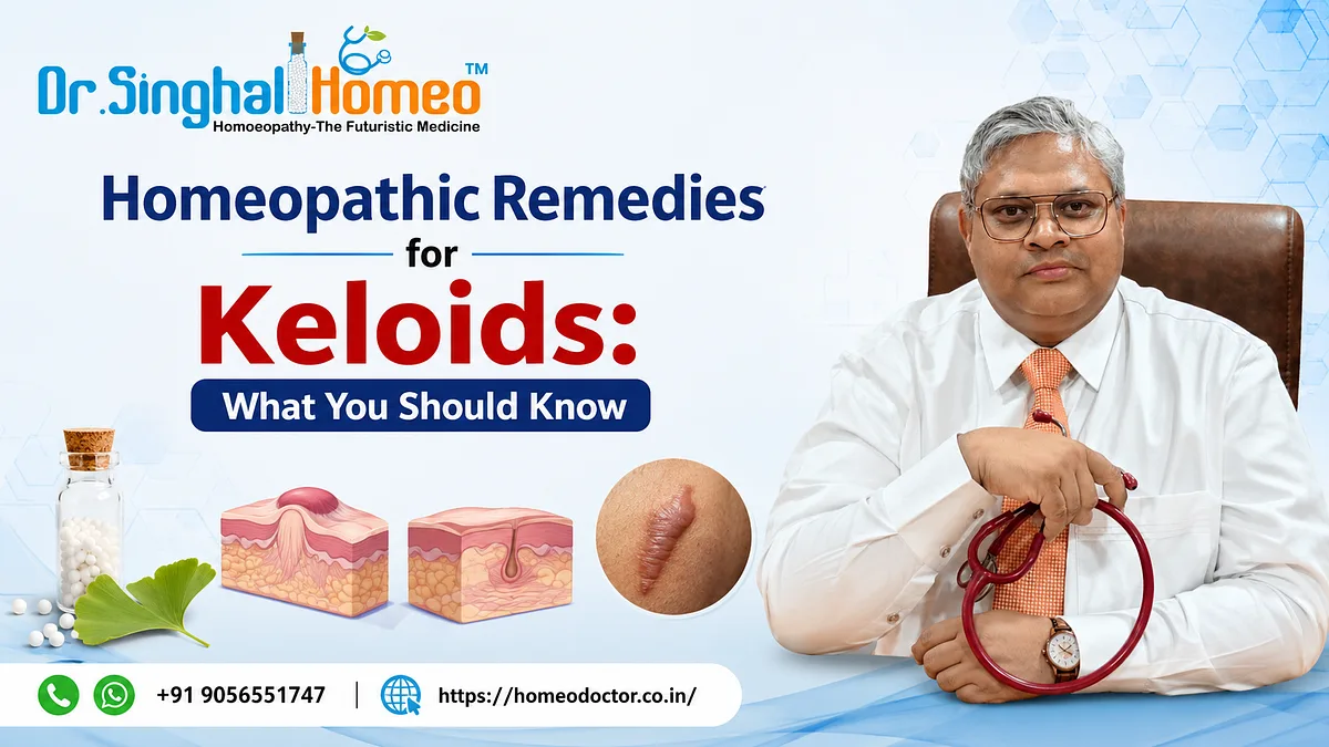 Homeopathic Remedies for Keloids: What You Should Know | by Dr. Singhal Homeo | Jul, 2026 | Medium