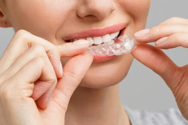 Straighten Your Smile Discreetly: Understanding Clear Aligner Treatment