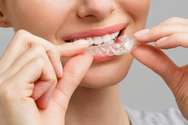 Straighten Your Smile Discreetly: Understanding Clear Aligner Treatment : evergreenortho — LiveJournal