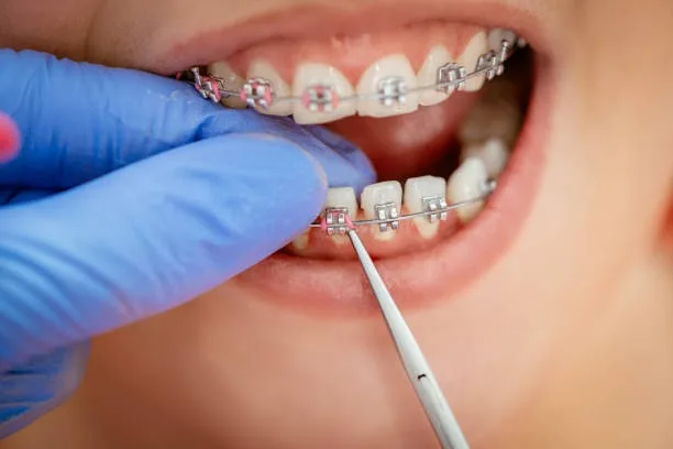 Beyond a Straighter Smile: What Modern Orthodontic Care Can Do for You