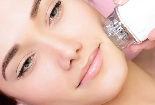 RF Microneedling Aargau | Renova Skin bei BeautyFirst