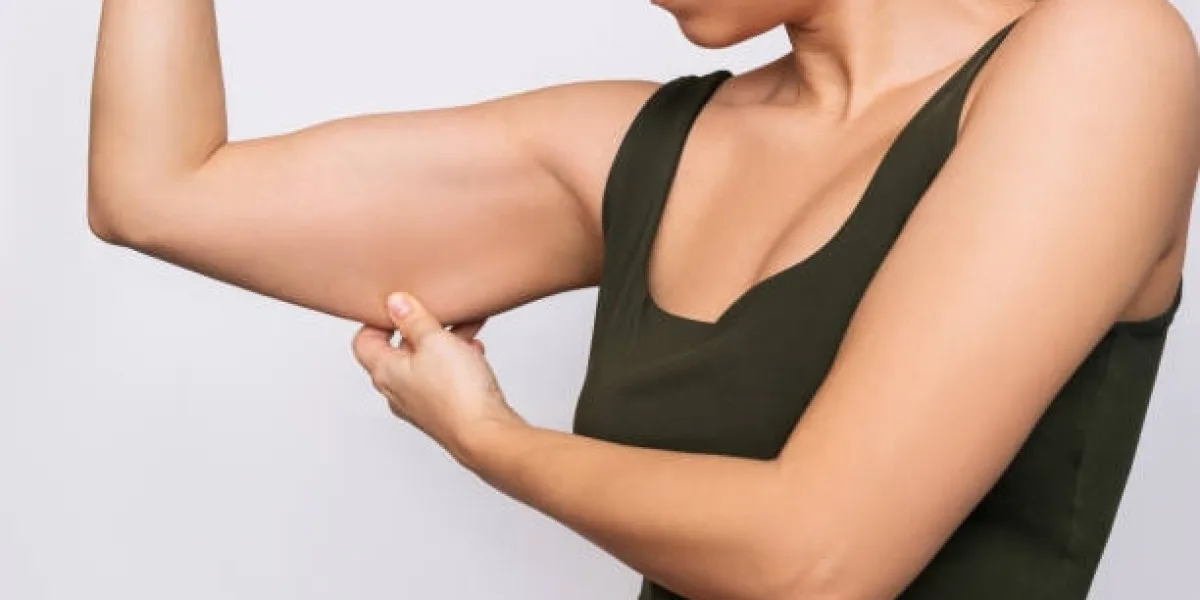Who Makes a Good Candidate for Arm Lift Surgery?