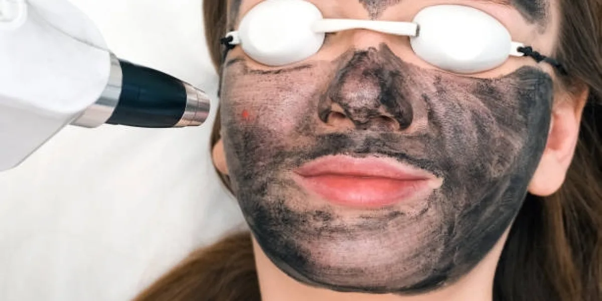 Spectra Laser Carbon Peel for Enlarged Pores: How It Works