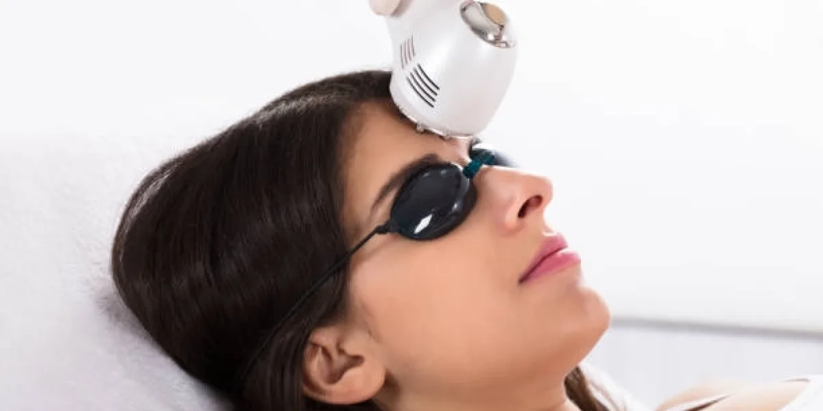 Questions to Ask During a Fractional Laser Treatment Consultation