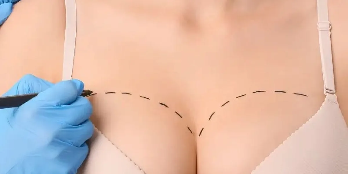 How Breast Augmentation Can Help You Feel More Confident in Your Body