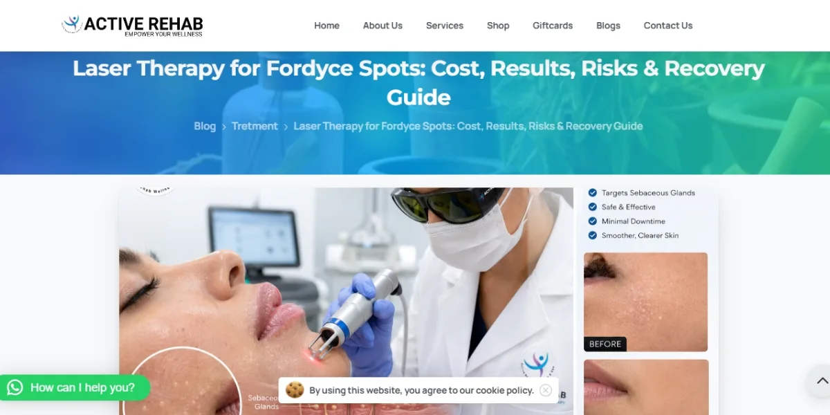Laser Treatment for Fordyce Spots Cost: Is Clearer Skin Worth the Price?