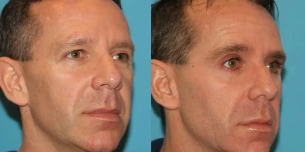 Modern Aesthetic Solutions for Facial Rejuvenation and Body Contouring