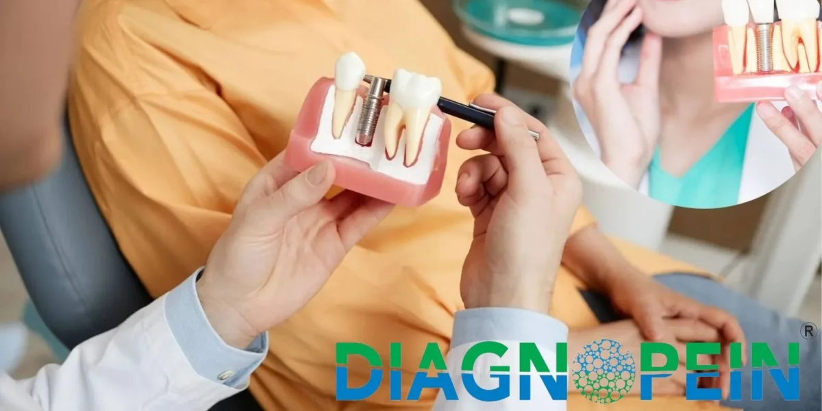Dental Implants in Pune: Restore Tooth Function and Smile